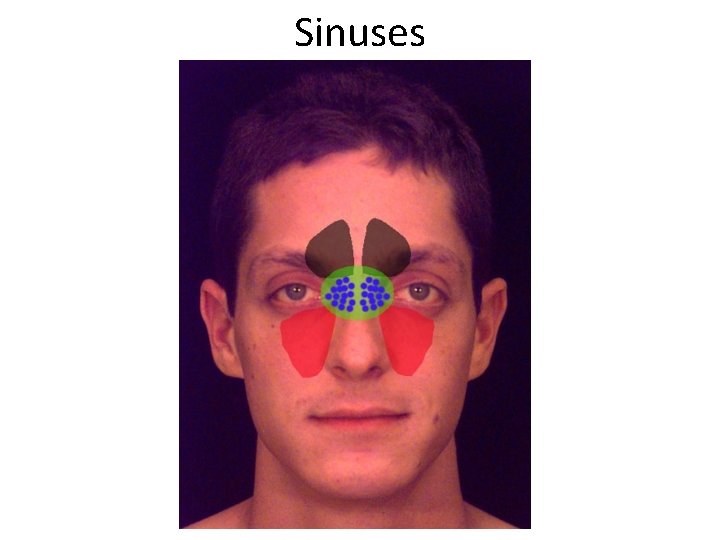 Sinuses 