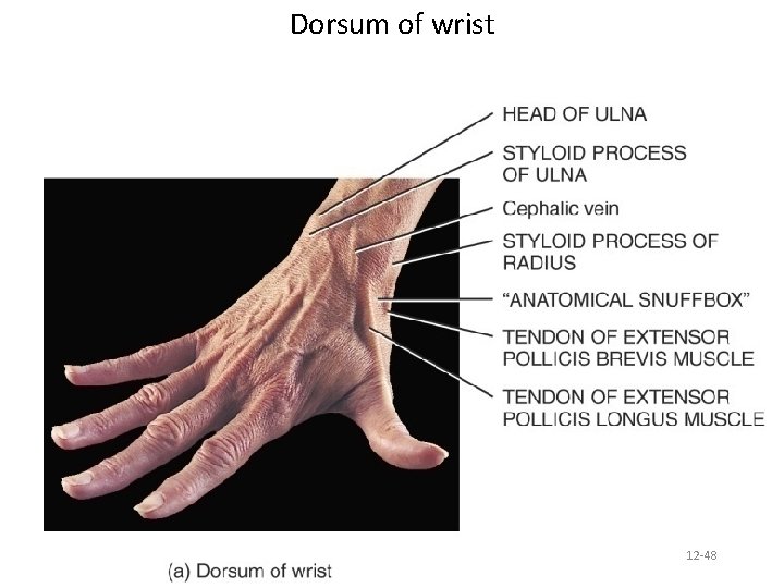 Dorsum of wrist 12 -48 