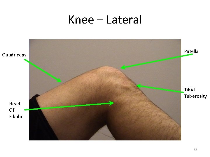 Knee – Lateral Quadriceps Patella Tibial Tuberosity Head Of Fibula 58 