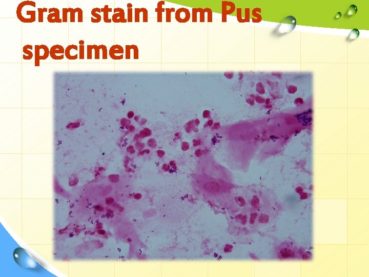 Gram stain from Pus specimen 