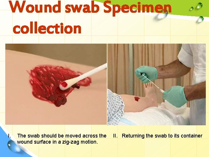 Wound swab Specimen collection I. The swab should be moved across the wound surface