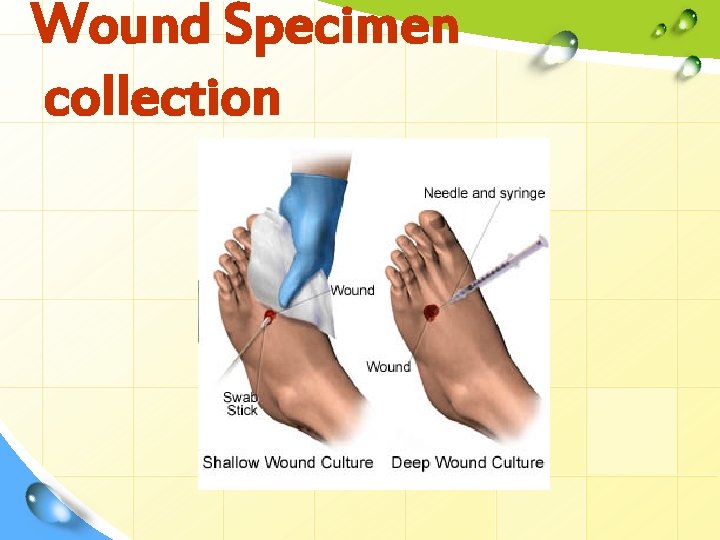 Wound Specimen collection 