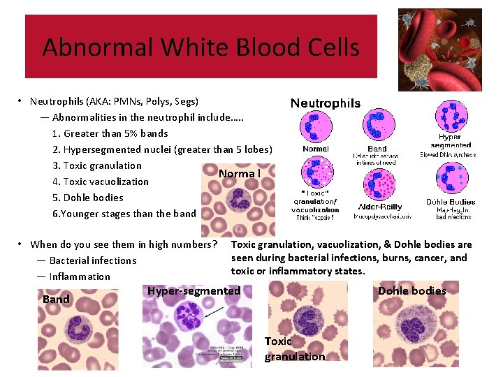 Abnormal White Blood Cells • Neutrophils (AKA: PMNs, Polys, Segs) — Abnormalities in the Abnormal White Blood Cells • Neutrophils (AKA: PMNs, Polys, Segs) — Abnormalities in the