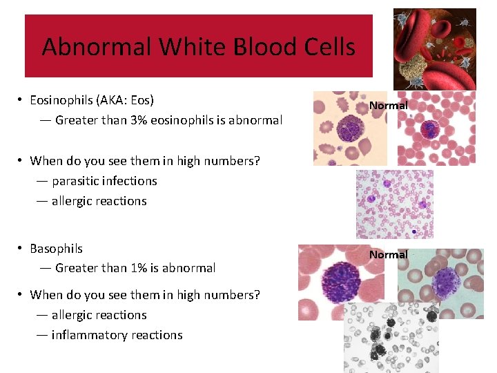 Abnormal White Blood Cells • Eosinophils (AKA: Eos) — Greater than 3% eosinophils is Abnormal White Blood Cells • Eosinophils (AKA: Eos) — Greater than 3% eosinophils is