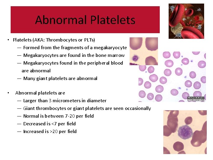 Abnormal Blood Cell Morphology Abnormal White Blood Cells Abnormal Blood Cell Morphology Abnormal White Blood Cells