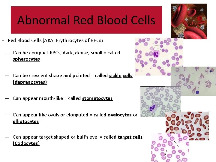 Abnormal Red Blood Cells • Red Blood Cells (AKA: Erythrocytes of RBCs) — Can Abnormal Red Blood Cells • Red Blood Cells (AKA: Erythrocytes of RBCs) — Can