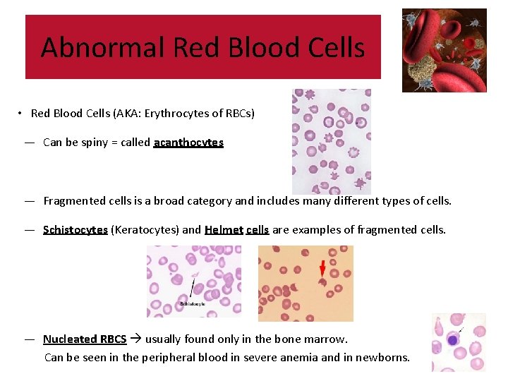 Abnormal Red Blood Cells • Red Blood Cells (AKA: Erythrocytes of RBCs) — Can Abnormal Red Blood Cells • Red Blood Cells (AKA: Erythrocytes of RBCs) — Can