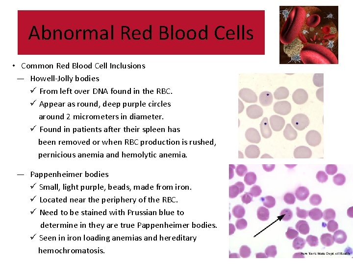 Abnormal Red Blood Cells • Common Red Blood Cell Inclusions — Howell-Jolly bodies ü Abnormal Red Blood Cells • Common Red Blood Cell Inclusions — Howell-Jolly bodies ü