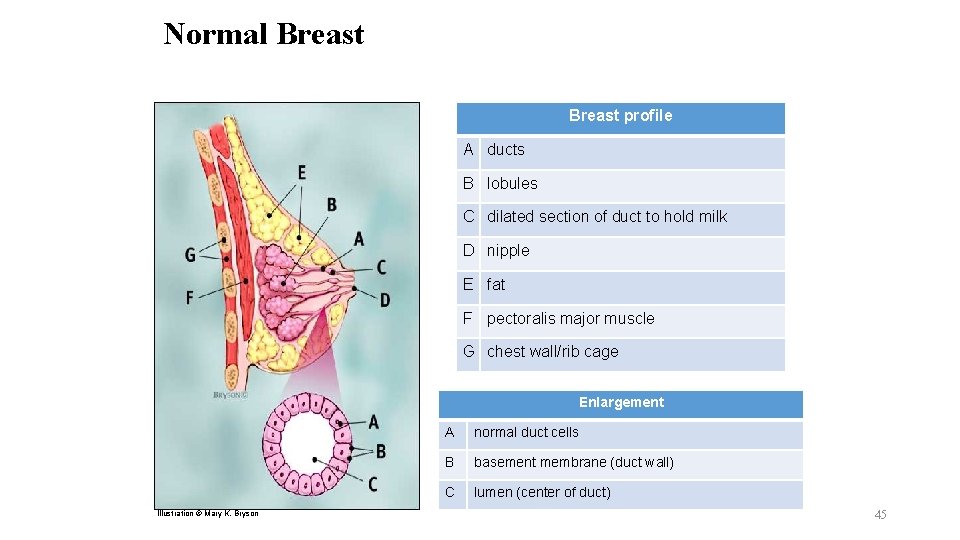 Normal Breast profile A ducts B lobules C dilated section of duct to hold