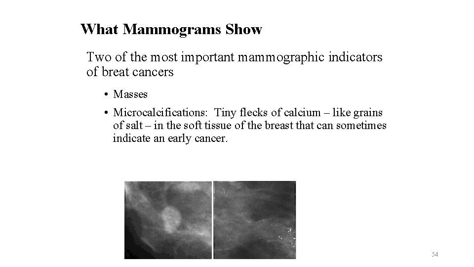 What Mammograms Show Two of the most important mammographic indicators of breat cancers •