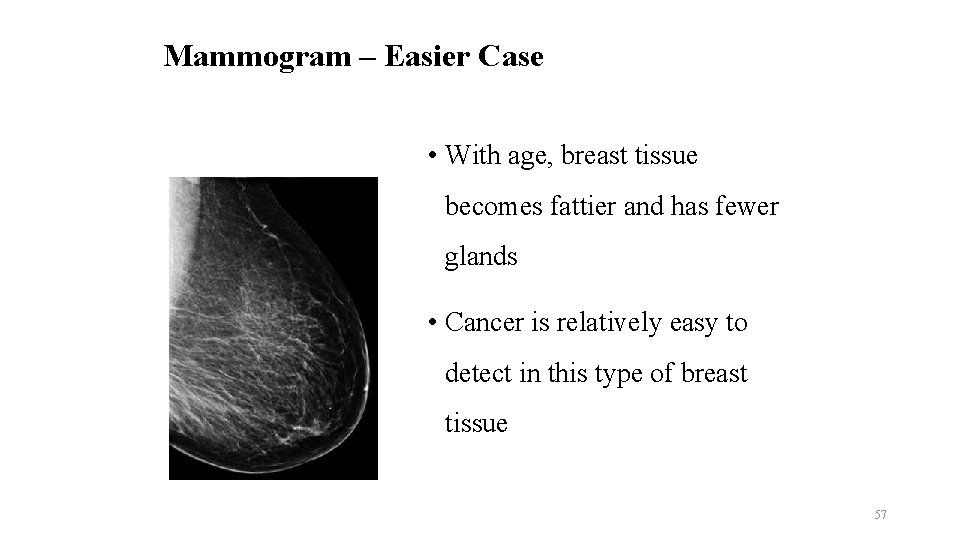 Mammogram – Easier Case • With age, breast tissue becomes fattier and has fewer