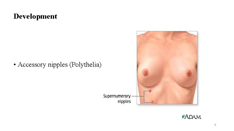 Development • Accessory nipples (Polythelia) 6 