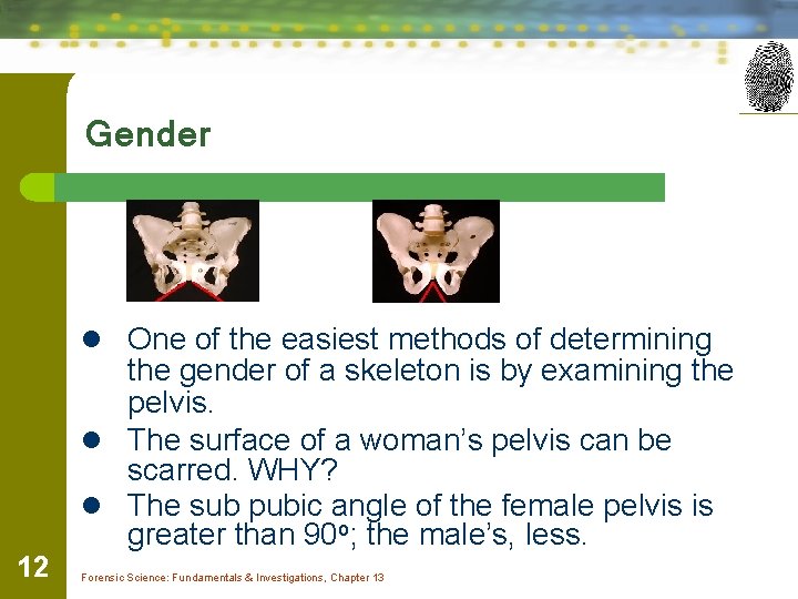Gender l One of the easiest methods of determining 12 the gender of a