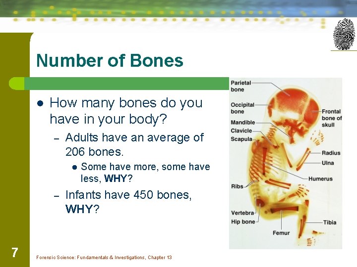 Number of Bones l How many bones do you have in your body? –