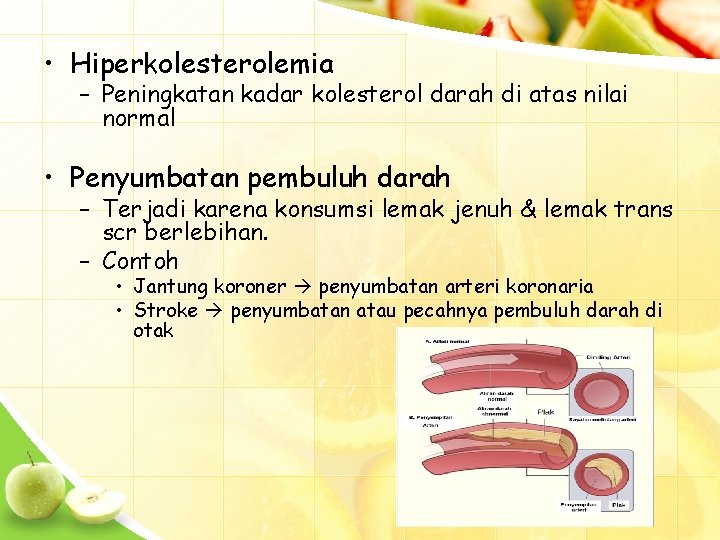  • Hiperkolesterolemia – Peningkatan kadar kolesterol darah di atas nilai normal • Penyumbatan