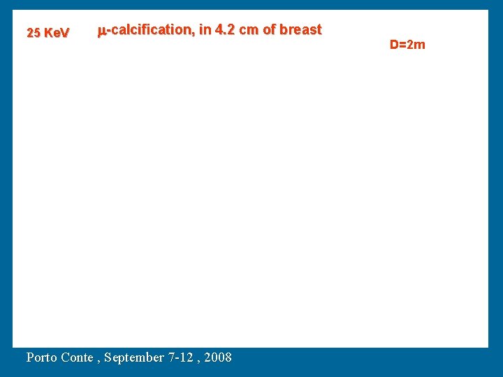 25 Ke. V m-calcification, in 4. 2 cm of breast Porto Conte , September