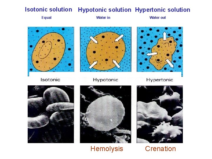 Isotonic solution Equal Hypotonic solution Hypertonic solution Water in Hemolysis Water out Crenation 