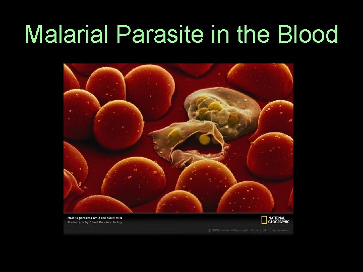 Malarial Parasite in the Blood  Malarial Parasite in the Blood