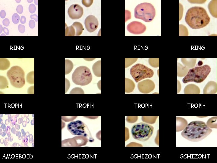 RING TROPH AMOEBOID RING TROPH SCHIZONT  RING TROPH AMOEBOID RING TROPH SCHIZONT