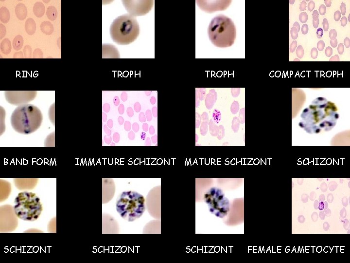 RING BAND FORM SCHIZONT TROPH COMPACT TROPH IMMATURE SCHIZONT SCHIZONT FEMALE GAMETOCYTE  RING BAND FORM SCHIZONT TROPH COMPACT TROPH IMMATURE SCHIZONT SCHIZONT FEMALE GAMETOCYTE