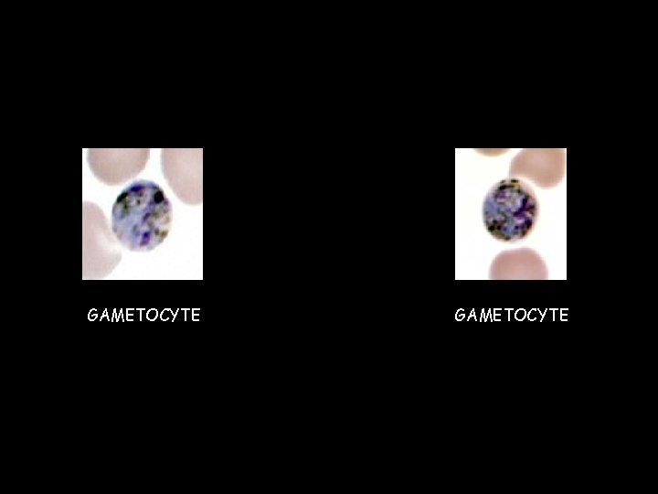 GAMETOCYTE  GAMETOCYTE