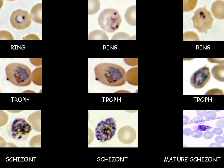 RING TROPH SCHIZONT MATURE SCHIZONT  RING TROPH SCHIZONT MATURE SCHIZONT