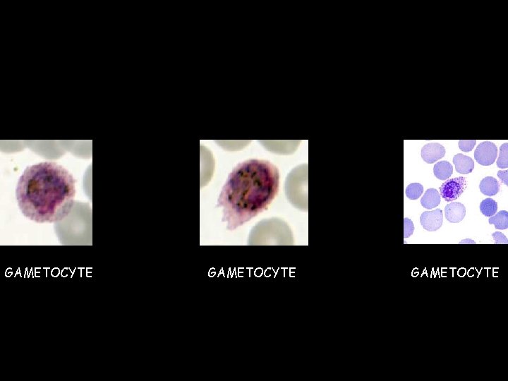 GAMETOCYTE  GAMETOCYTE