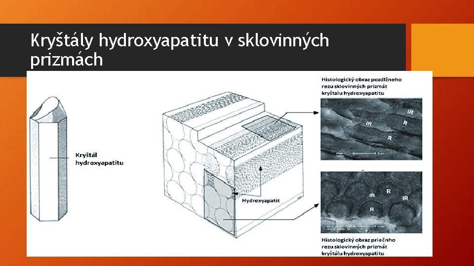 Kryštály hydroxyapatitu v sklovinných prizmách 