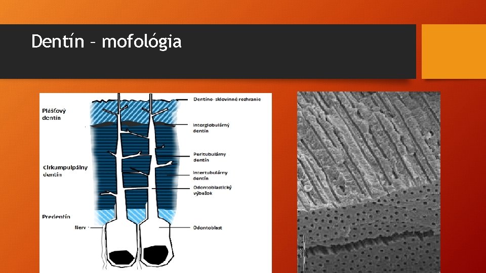 Dentín – mofológia 