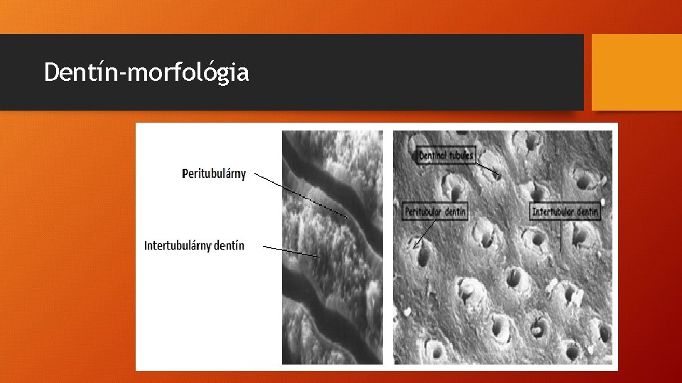 Dentín-morfológia 