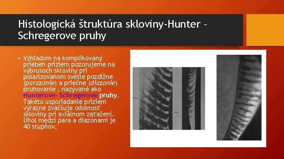 Histologická štruktúra skloviny-Hunter – Schregerove pruhy • Vzhľadom na komplikovaný priebeh priziem pozorujeme na