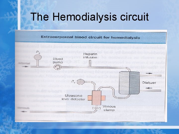 The Hemodialysis circuit 