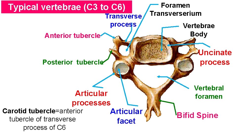 Typical vertebrae (C 3 to C 6) Transverse process Anterior tubercle Posterior tubercle Articular