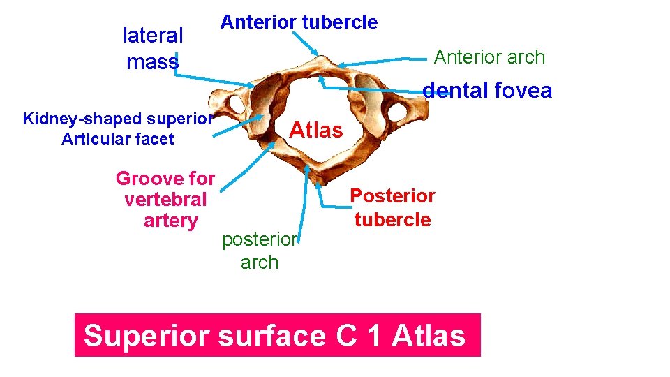 lateral mass Anterior tubercle Anterior arch dental fovea Kidney-shaped superior Articular facet Groove for