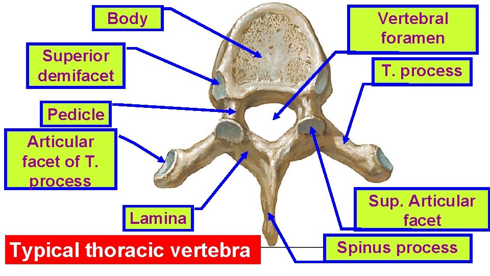 Body Superior demifacet Vertebral foramen T. process Pedicle Articular facet of T. process Lamina