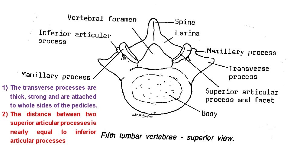 1) The transverse processes are thick, strong and are attached to whole sides of