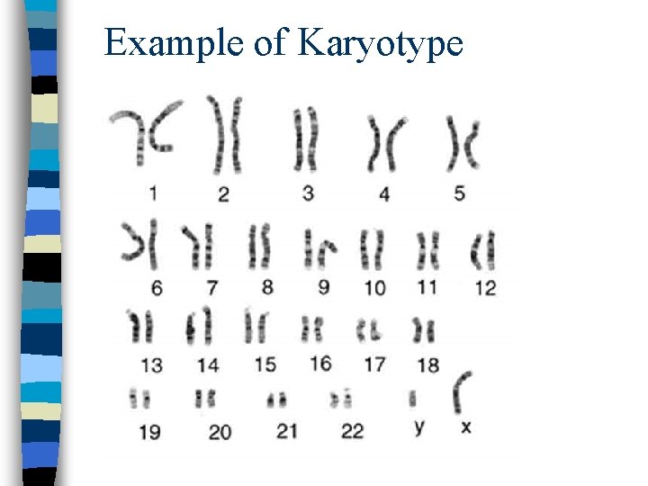 Example of Karyotype 