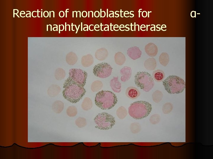 Reaction of monoblastes for naphtylacetateestherase α- 