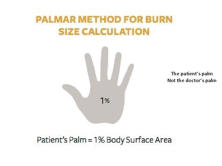 The patient’s palm Not the doctor’s palm 