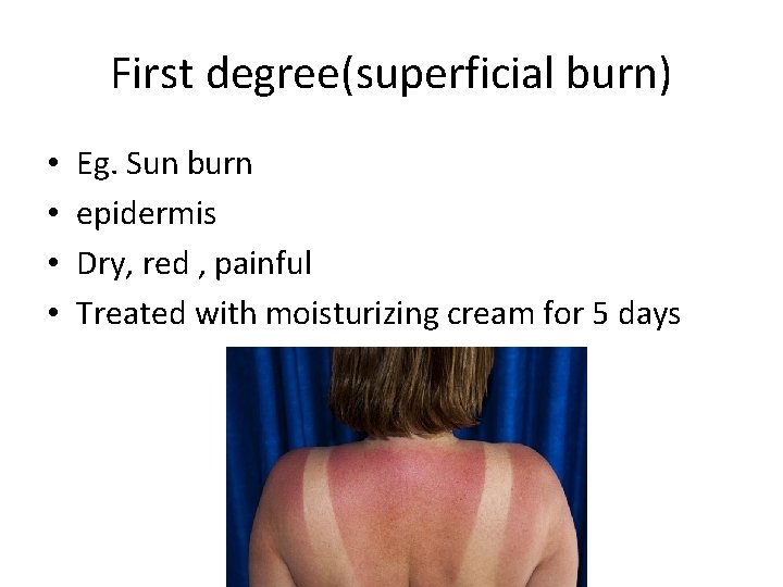 First degree(superficial burn) • • Eg. Sun burn epidermis Dry, red , painful Treated