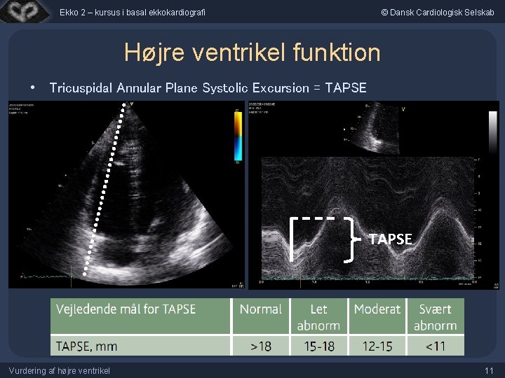 Ekko 2 – kursus i basal ekkokardiografi © Dansk Cardiologisk Selskab Højre ventrikel funktion