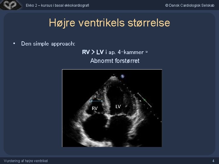 Ekko 2 – kursus i basal ekkokardiografi © Dansk Cardiologisk Selskab Højre ventrikels størrelse