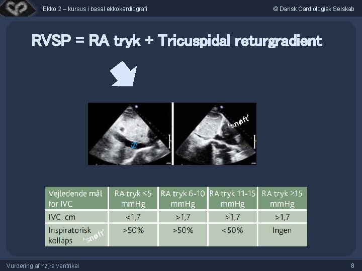 Ekko 2 – kursus i basal ekkokardiografi © Dansk Cardiologisk Selskab RVSP = RA