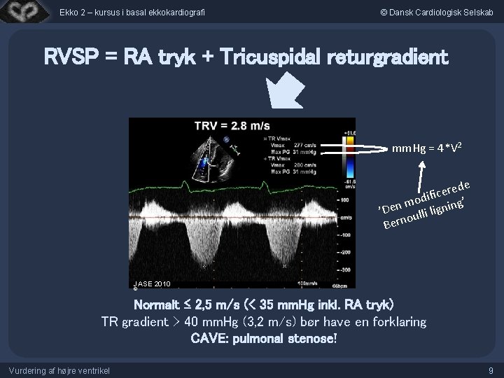 Ekko 2 – kursus i basal ekkokardiografi © Dansk Cardiologisk Selskab RVSP = RA