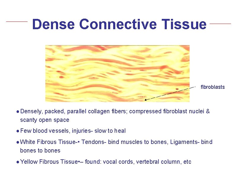 Dense Connective Tissue fibroblasts ● Densely, packed, parallel collagen fibers; compressed fibroblast nuclei &