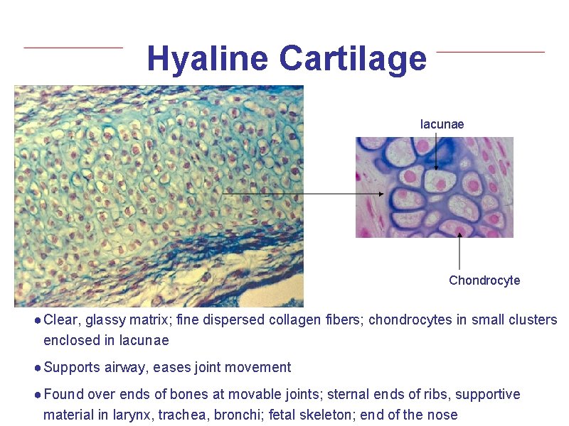 Hyaline Cartilage lacunae Chondrocyte ● Clear, glassy matrix; fine dispersed collagen fibers; chondrocytes in