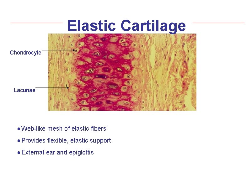 Elastic Cartilage Chondrocyte Lacunae ● Web-like mesh of elastic fibers ● Provides flexible, elastic