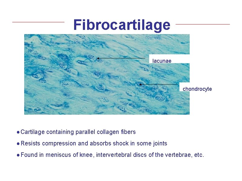 Fibrocartilage lacunae chondrocyte ● Cartilage containing parallel collagen fibers ● Resists compression and absorbs