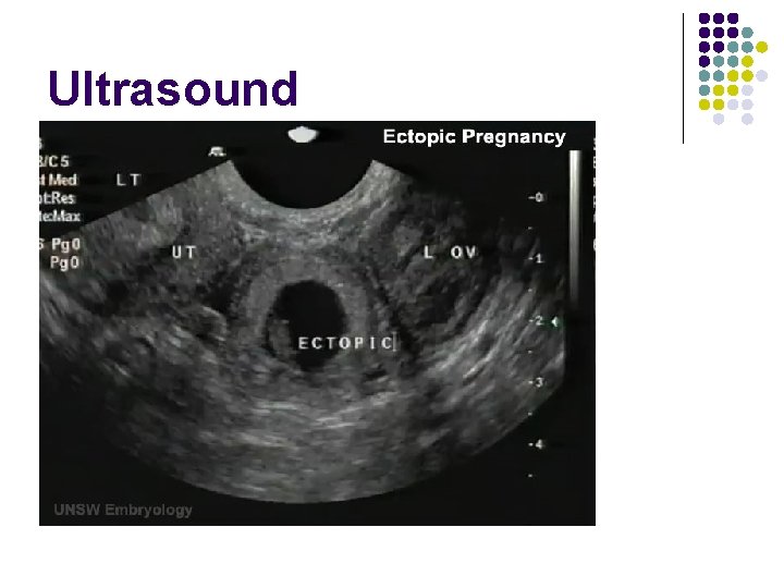 Ultrasound 