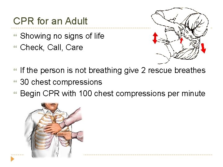 CPR for an Adult Showing no signs of life Check, Call, Care If the